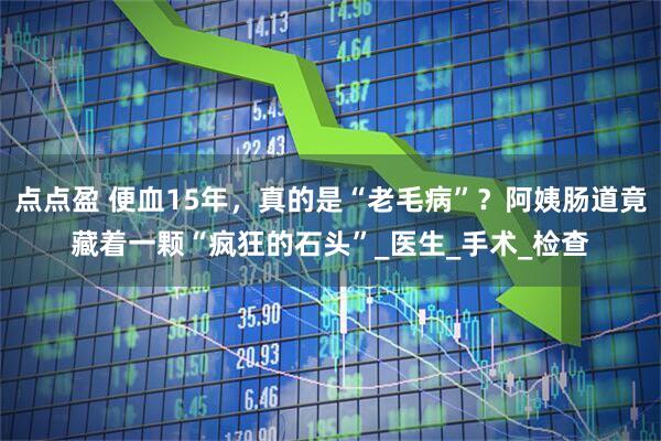 点点盈 便血15年，真的是“老毛病”？阿姨肠道竟藏着一颗“疯狂的石头”_医生_手术_检查